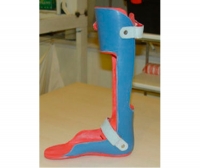 Ankle and foot orthosis (AFO)