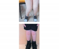 Dynamic Lycra®