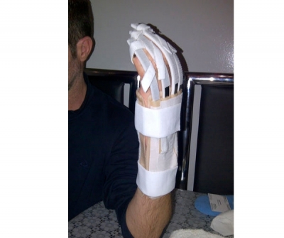 Finger orthosis / finger flexion