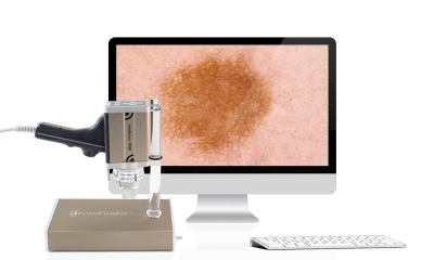 FotoFinder dermoscope iMac