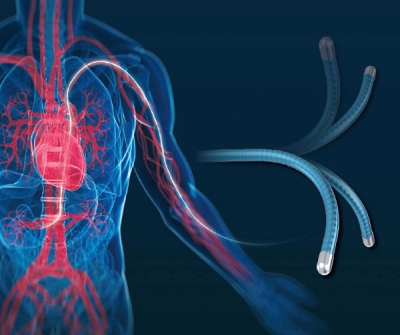 Iberis® - Renal denervation system