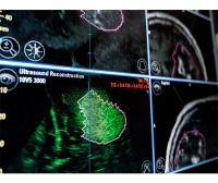 Intraoperative software