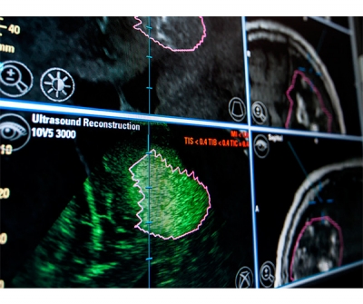 Intraoperative software