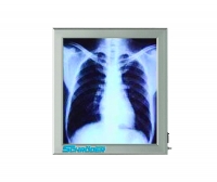 NEGATOSCOPE, SINGLE, SLIM - NT 110