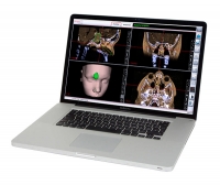 Scopis® Planning Station